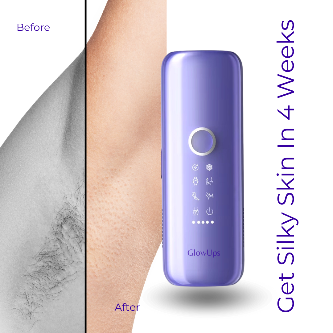 GlowUps IPL Laser Hair Removal