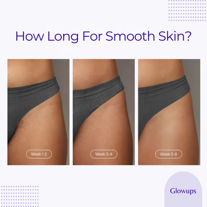 GlowUps IPL Laser Hair Removal